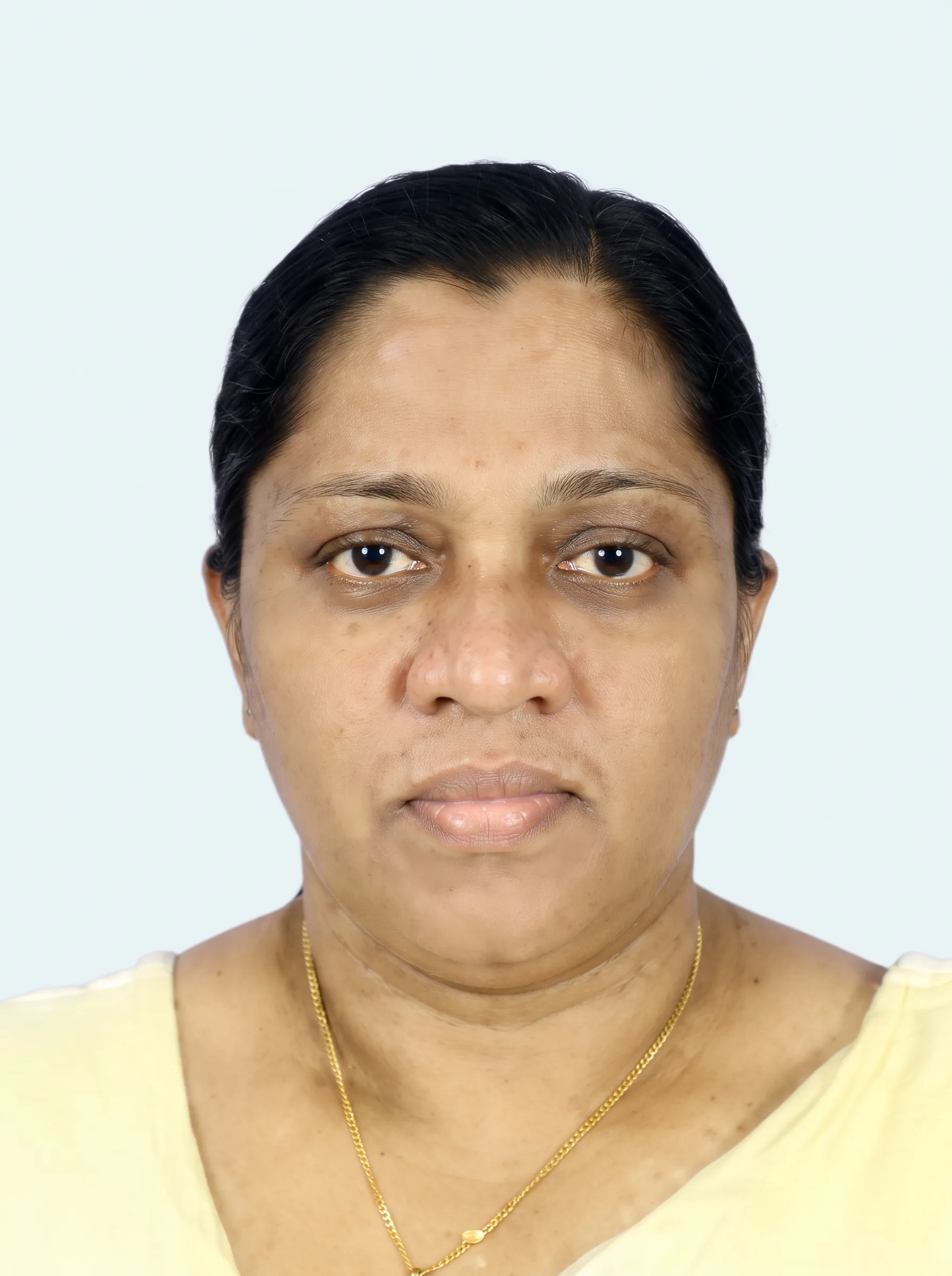 Ms. N. A. A. Shamali